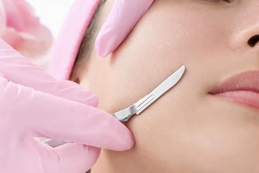 Dermaplaning